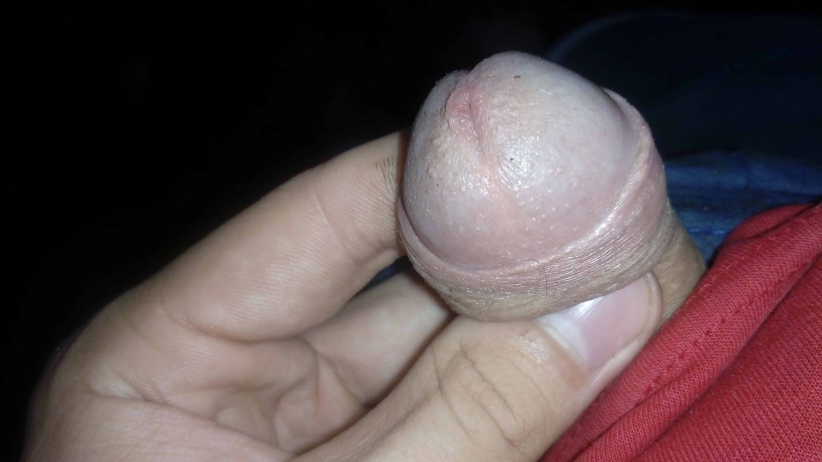 Головка пениса младенца