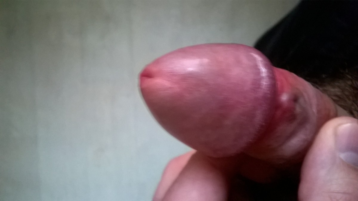 Волосы на головке пениса