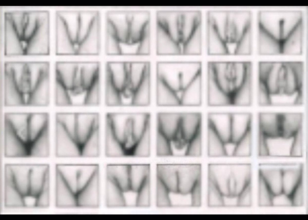 Женские вагины вид спереди